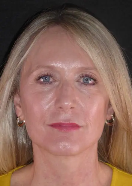 Jane, 50