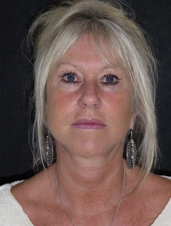 Liz, 57