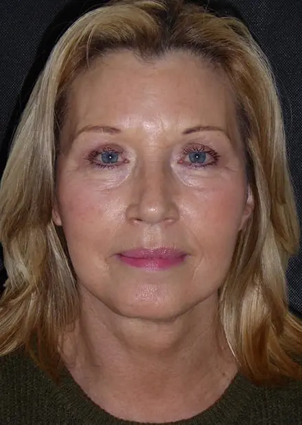 Maureen, 62