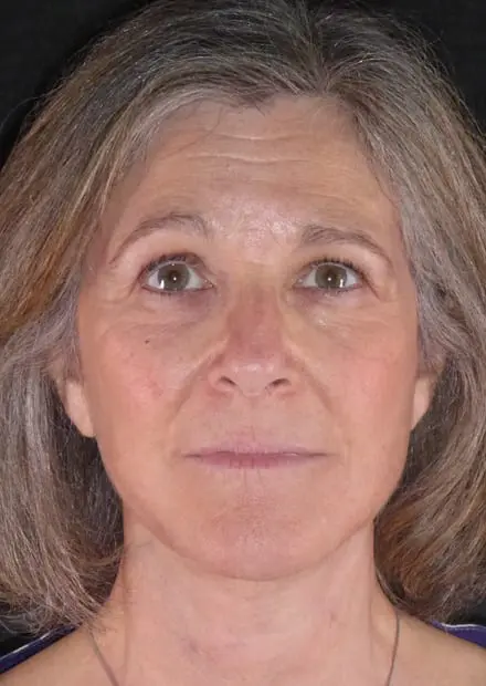 Ruth, 60