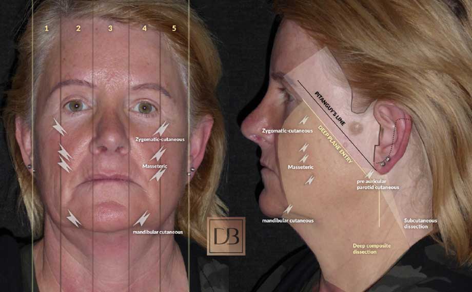 Ageing face signs