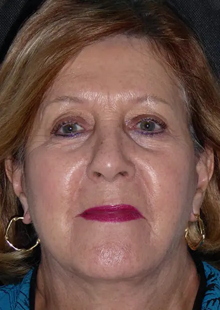 Linda, 64