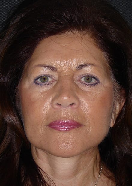 Linda, 66