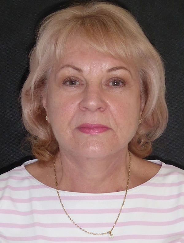 Susan, 65