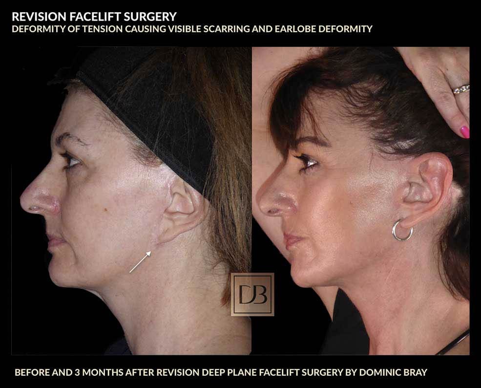 Bad facelift shop