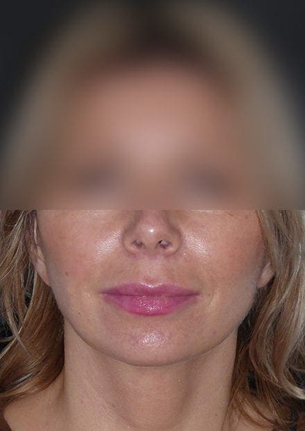Emma, 46